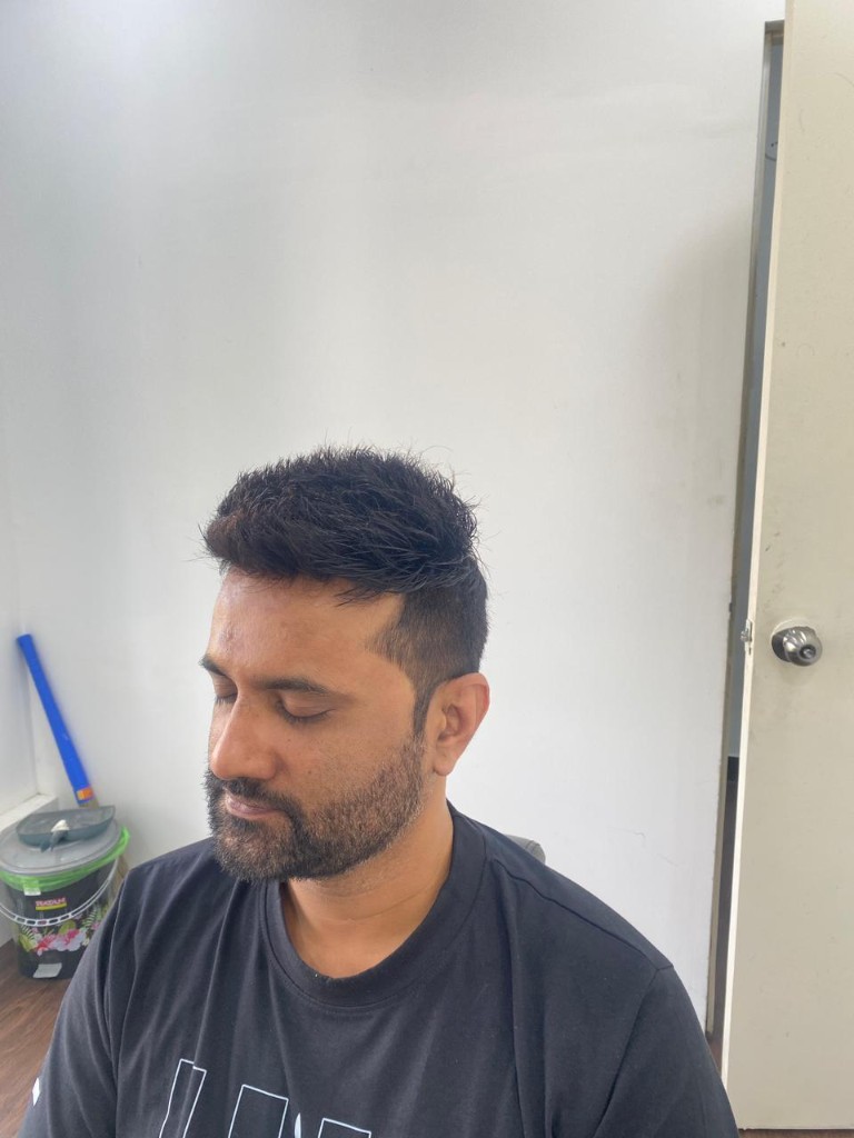 After hair patch treatment