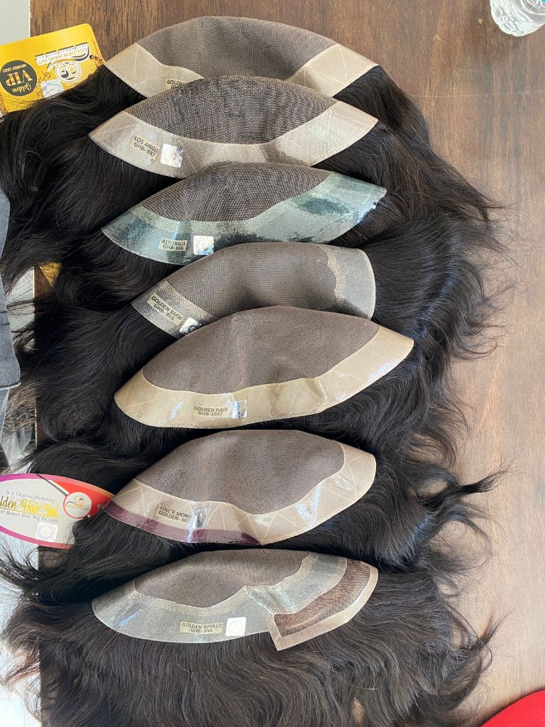 Hair loss assessment
