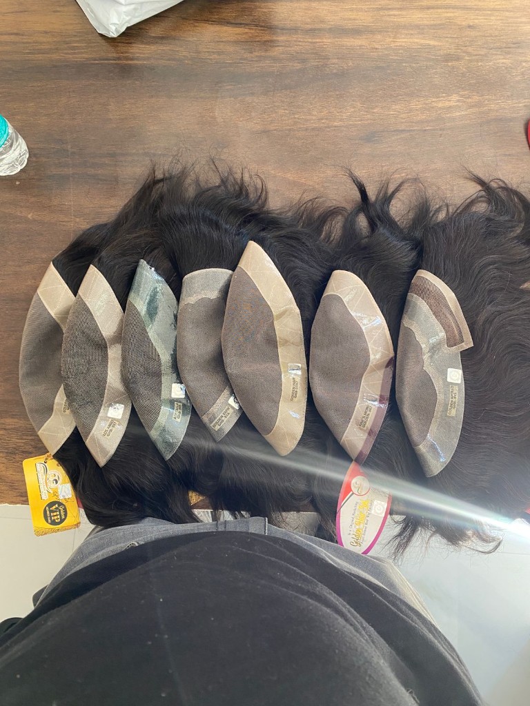 Male pattern baldness