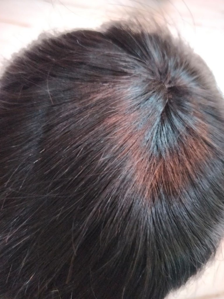 Hair patch maintenance service