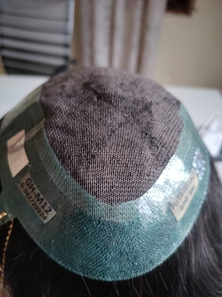 Hair patch replacement