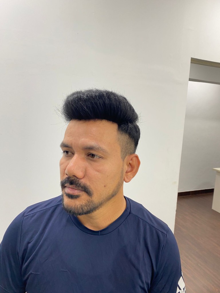 Hair patch treatment at Eagle Hair Patch Studio